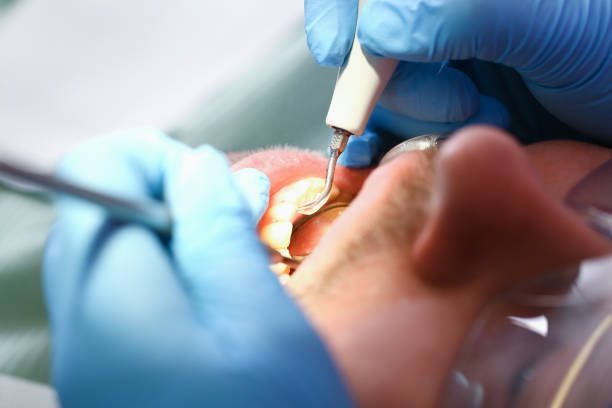 Best Dental Abscess Treatment in Shenandoah, TX