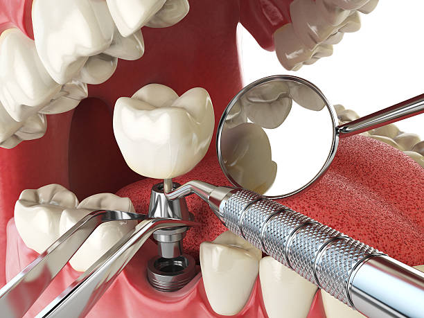 Best Walk-In Emergency Dental Services in Shenandoah, TX
